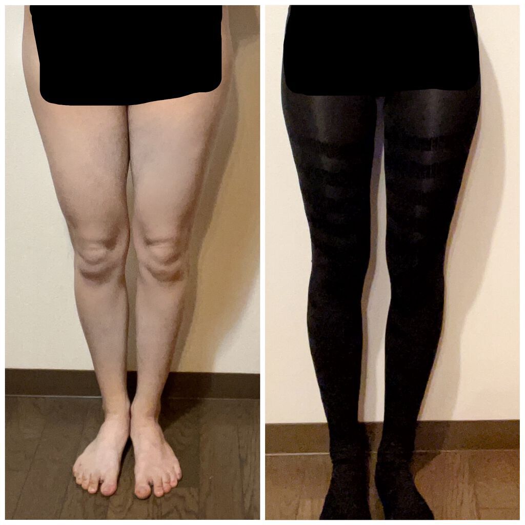 スリムタイツ/BELMISE/着圧ソックス・レギンスを使ったクチコミ（2枚目）