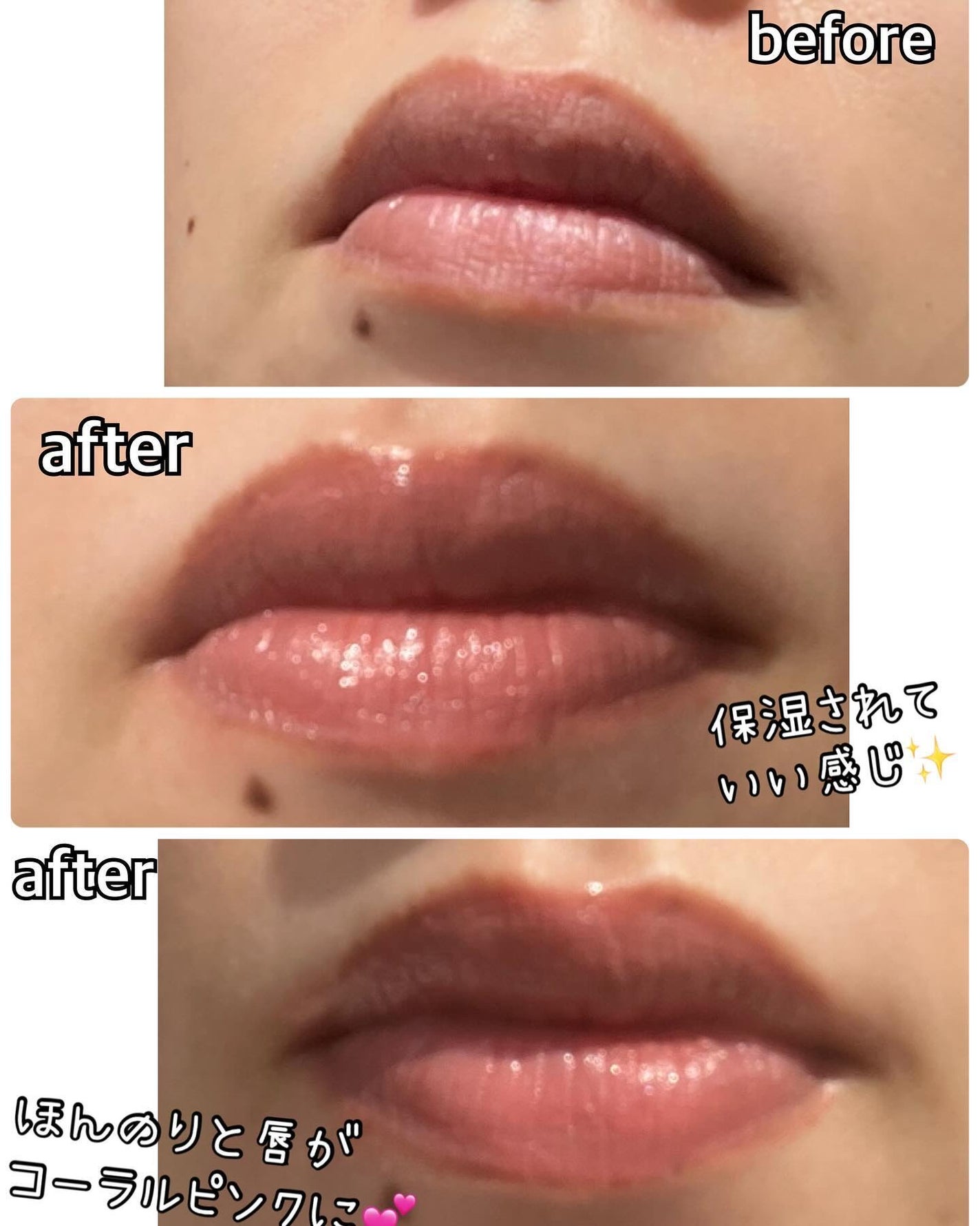 シャンティ on LIPS 「#PR#コエタスのキャンペーンにていただいた商品のレビューです..」(6枚目)