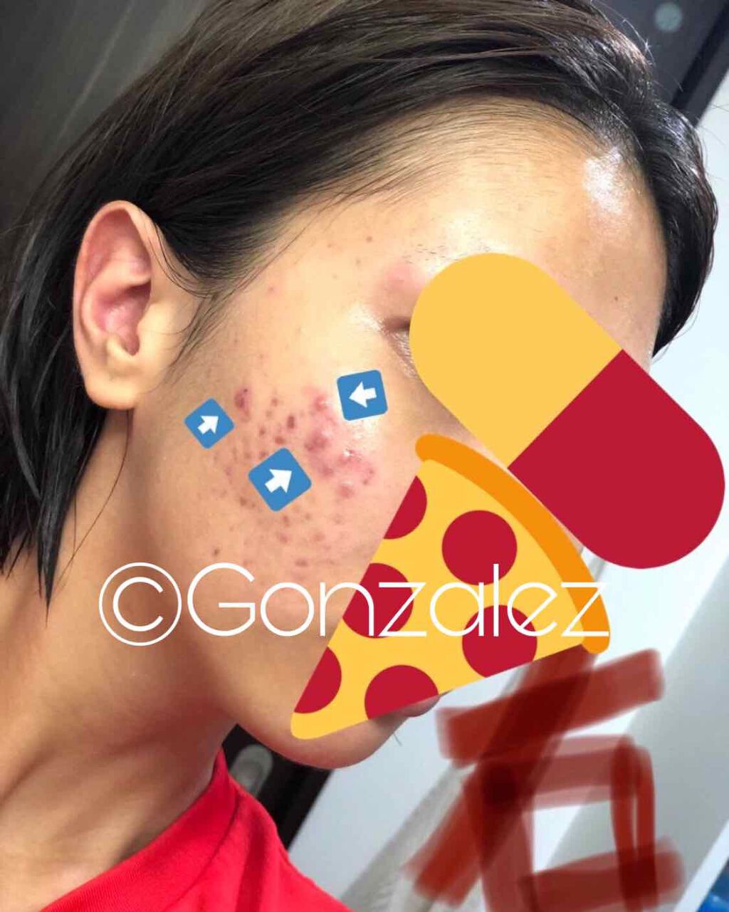 1025 独島 トナー/ROUND LAB/化粧水を使ったクチコミ（2枚目）