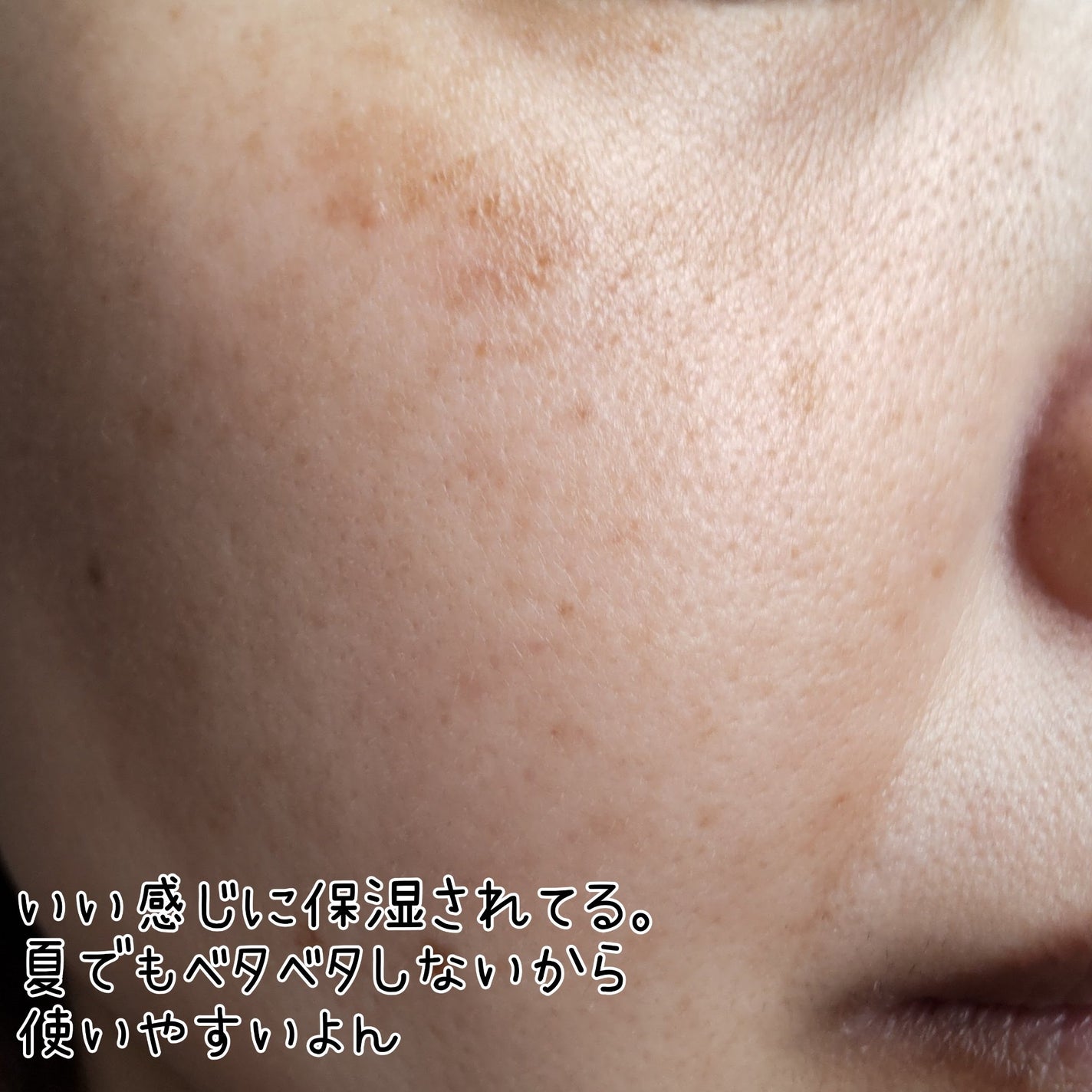 薬用 雪肌精 エンリッチ/雪肌精/化粧水を使ったクチコミ(4枚目)