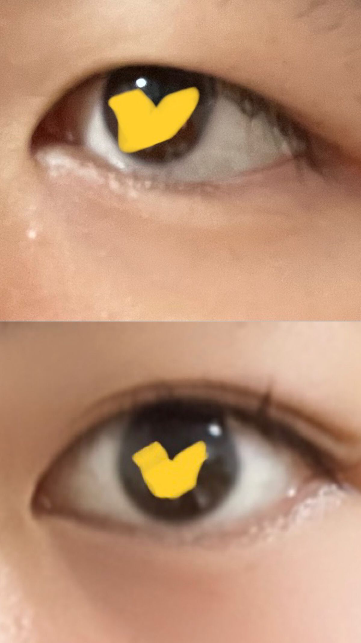 のびーるアイテープ(絆創膏タイプ、レギュラー)/DAISO/二重まぶた用アイテムを使ったクチコミ(2枚目)