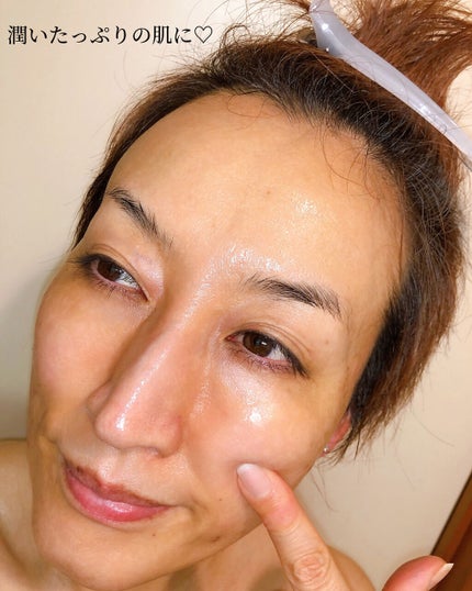 H9 ヒアルロニック アンプルマスク/JMsolution/シートマスク・パックを使ったクチコミ(9枚目)