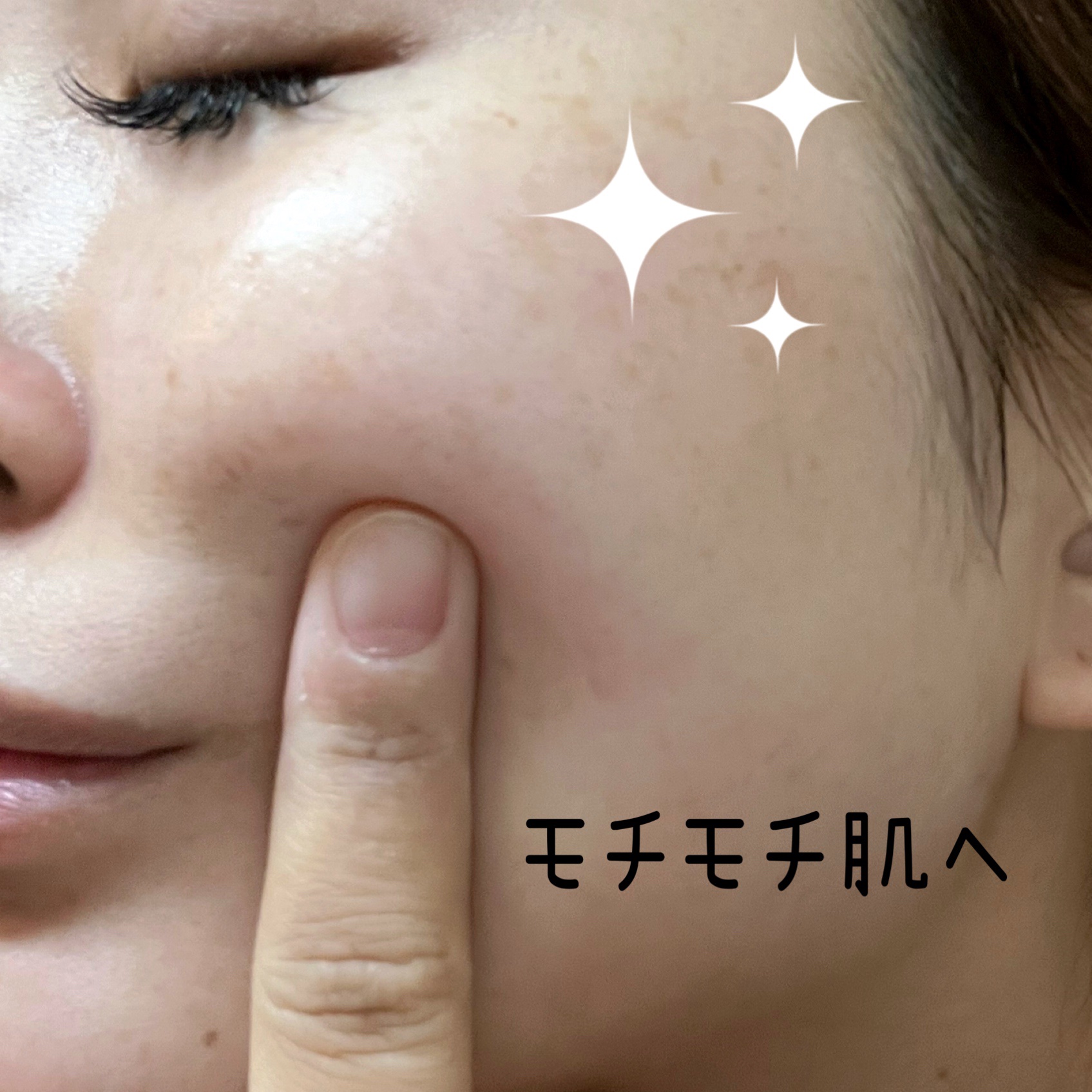 センテラ アンプル/SKIN1004/美容液を使ったクチコミ（3枚目）