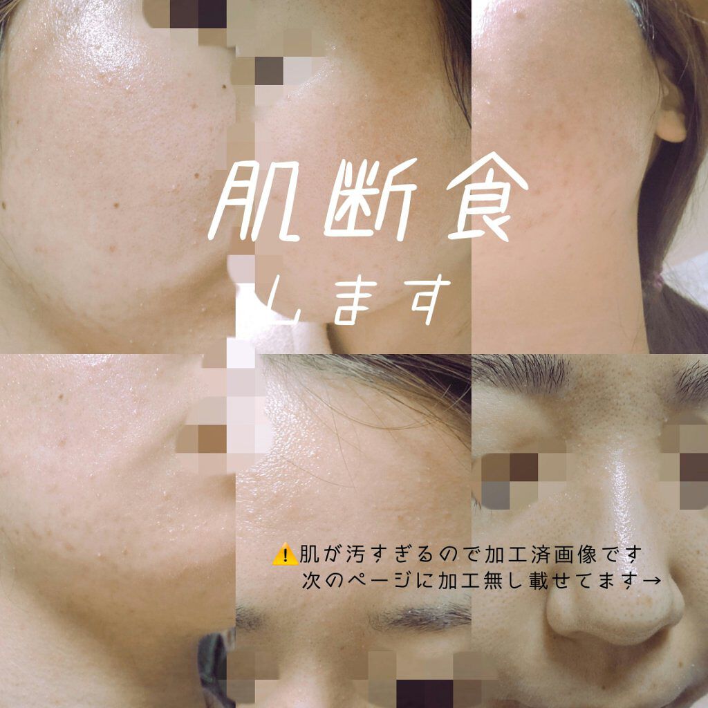 オードムーゲ 薬用ローション（ふきとり化粧水）/オードムーゲ/拭き取り化粧水を使ったクチコミ（1枚目）