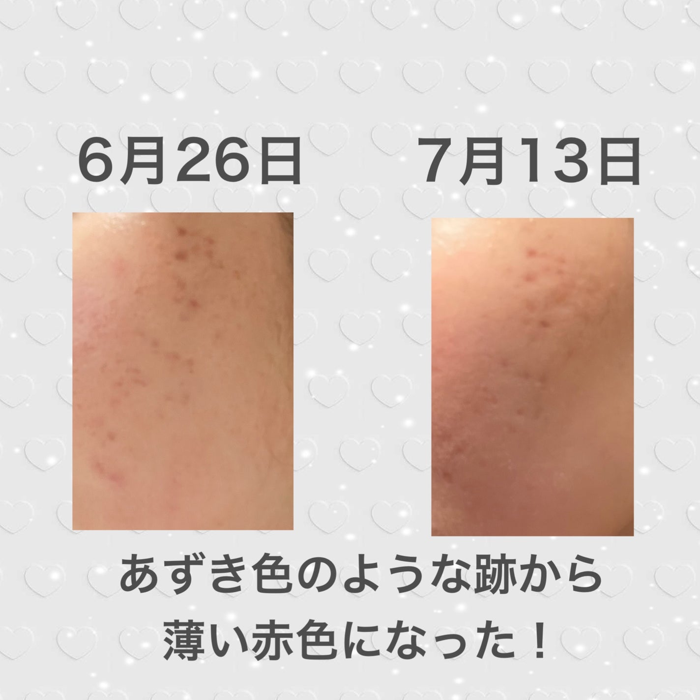 チョコラBB ルーセントC(医薬品)/チョコラBB/その他を使ったクチコミ(3枚目)