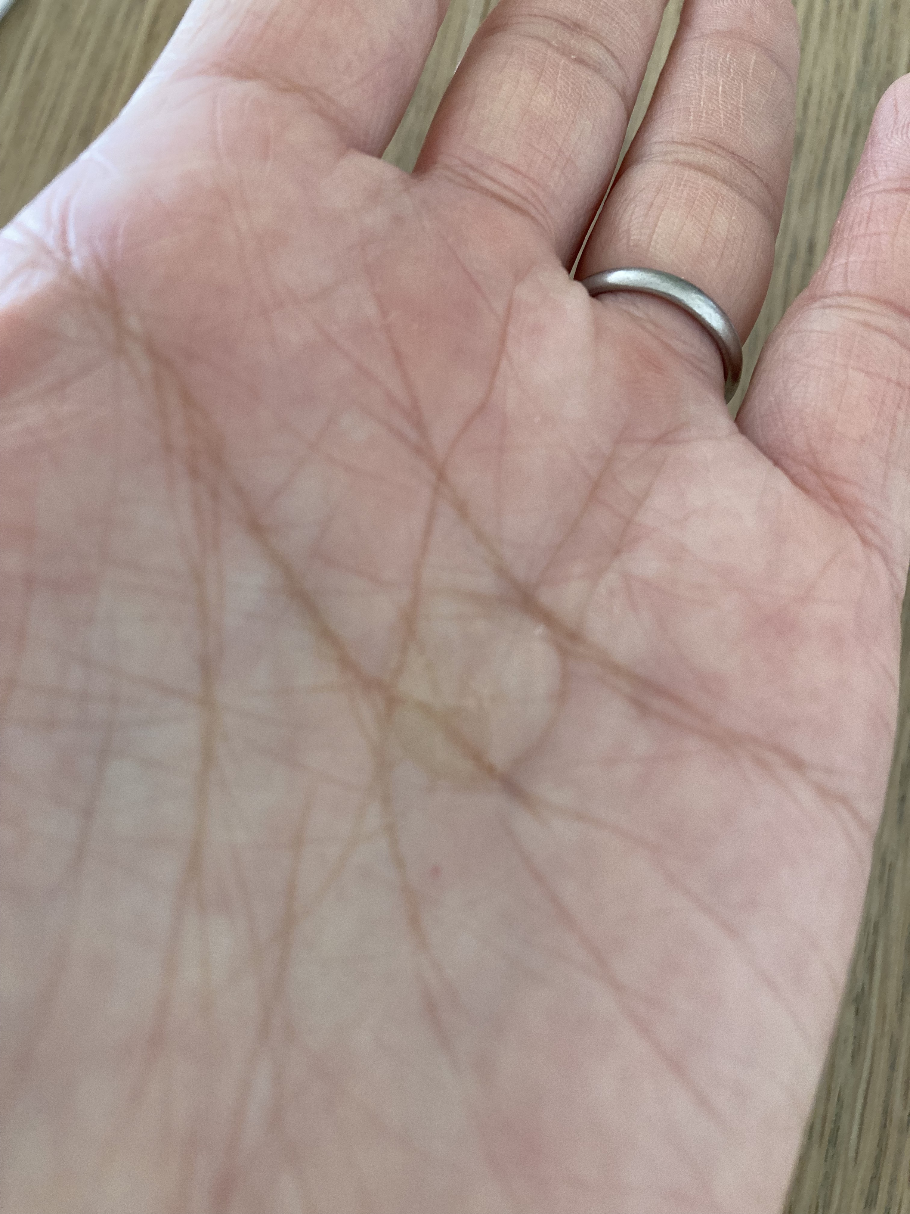 ゲルローション/ストレピア/オールインワン化粧品を使ったクチコミ（3枚目）