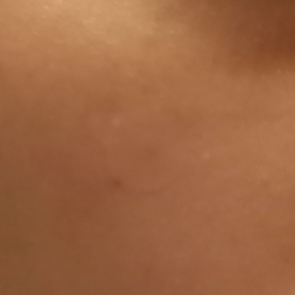 A-zero Shot スキンドレッシングパッチ/MEDIHEAL/シートマスク・パックを使ったクチコミ(6枚目)