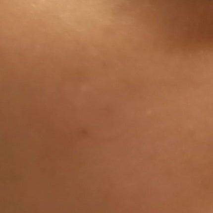 A-zero Shot スキンドレッシングパッチ/MEDIHEAL/シートマスク・パックを使ったクチコミ(6枚目)