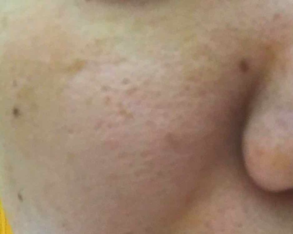 ウォッシャブル コールド クリーム/ちふれ/クレンジングクリームを使ったクチコミ（3枚目）