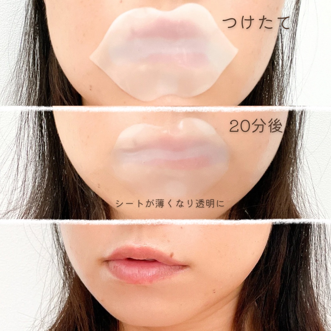 リップパック ふっくらハリ感タイプ＜ハーバルハニーの香り＞ 1枚入/CHOOSY/リップマスクを使ったクチコミ（2枚目）