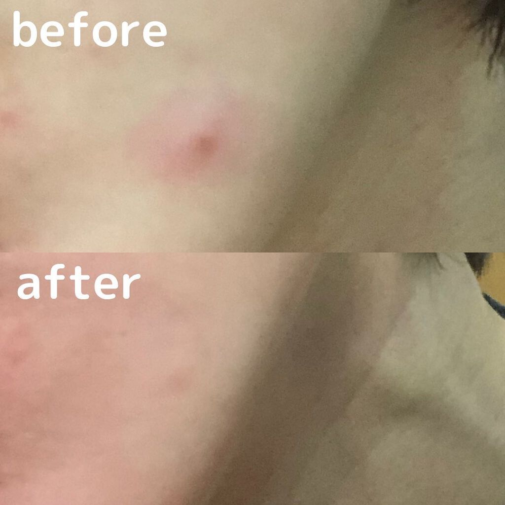 stress out solution a-clear duo/BELLAMONSTER/その他スキンケアを使ったクチコミ(2枚目)