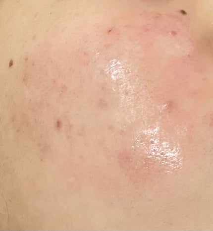 を使ったクチコミ(2枚目)