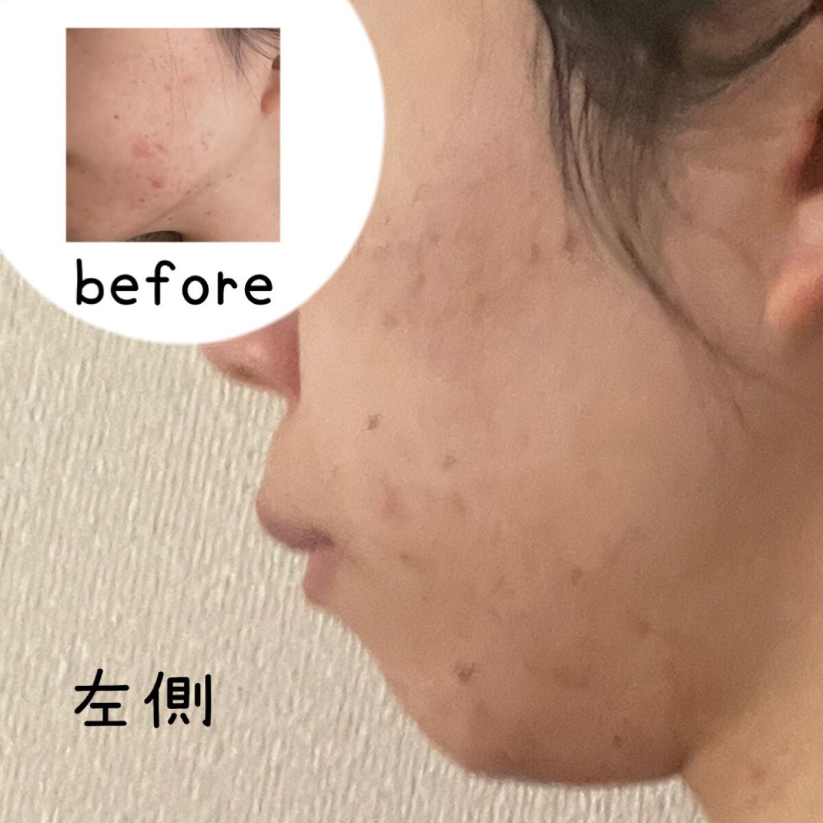 モイスチャージェル/パーフェクトワン/オールインワン化粧品を使ったクチコミ(2枚目)