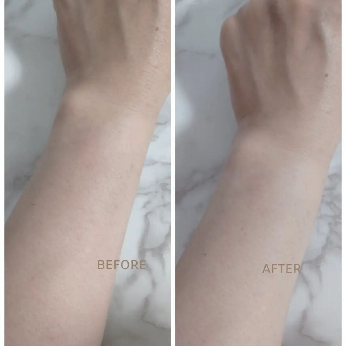 コードレス脱毛器/Noend/家庭用脱毛器を使ったクチコミ(6枚目)