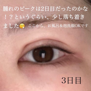 すぅ on LIPS 「私は、4年前から少しずつプチ整形も含めて、整形しています！20..」（7枚目）