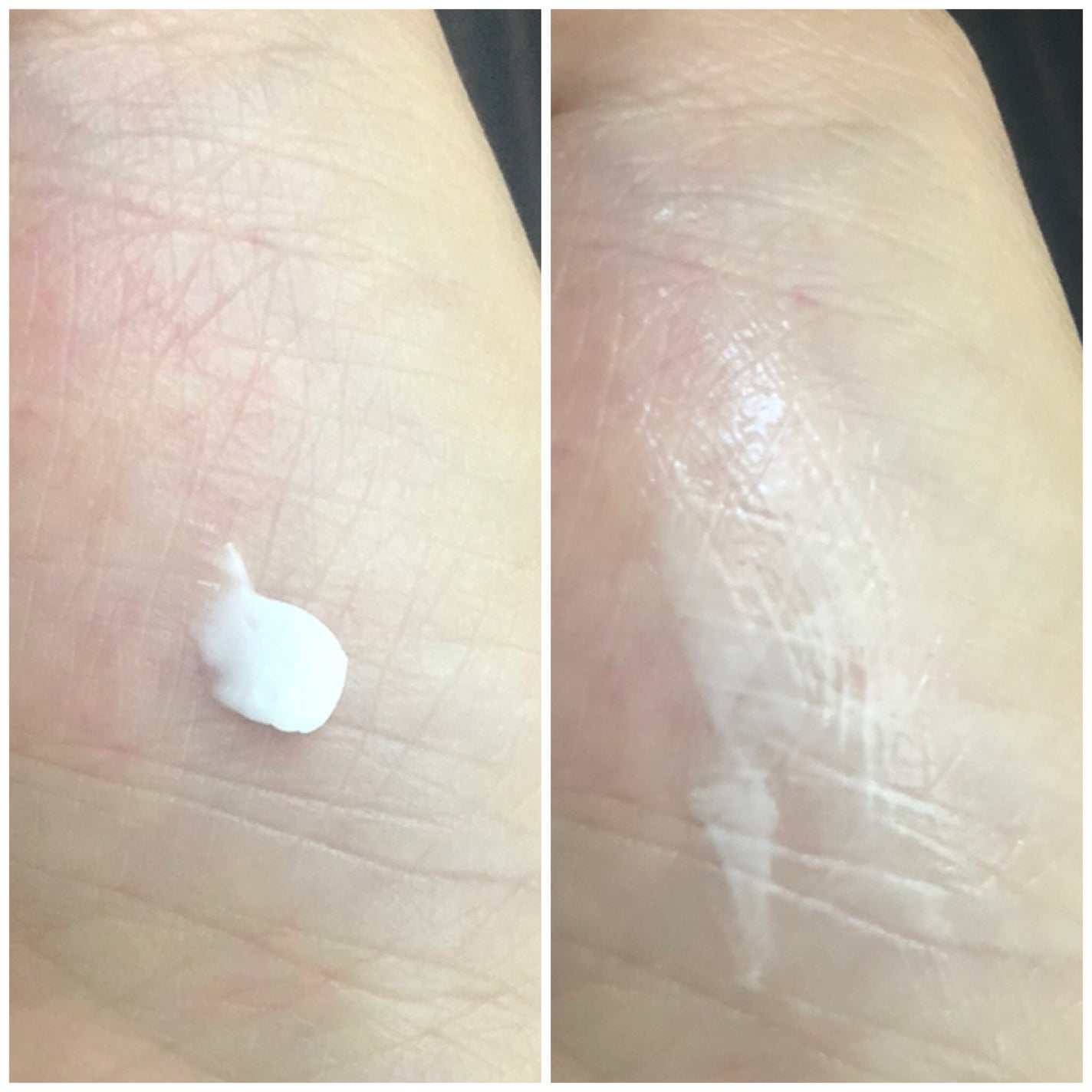 ダーマセプトRX AZAセラム/ダーマセプトRX/美容液を使ったクチコミ(3枚目)