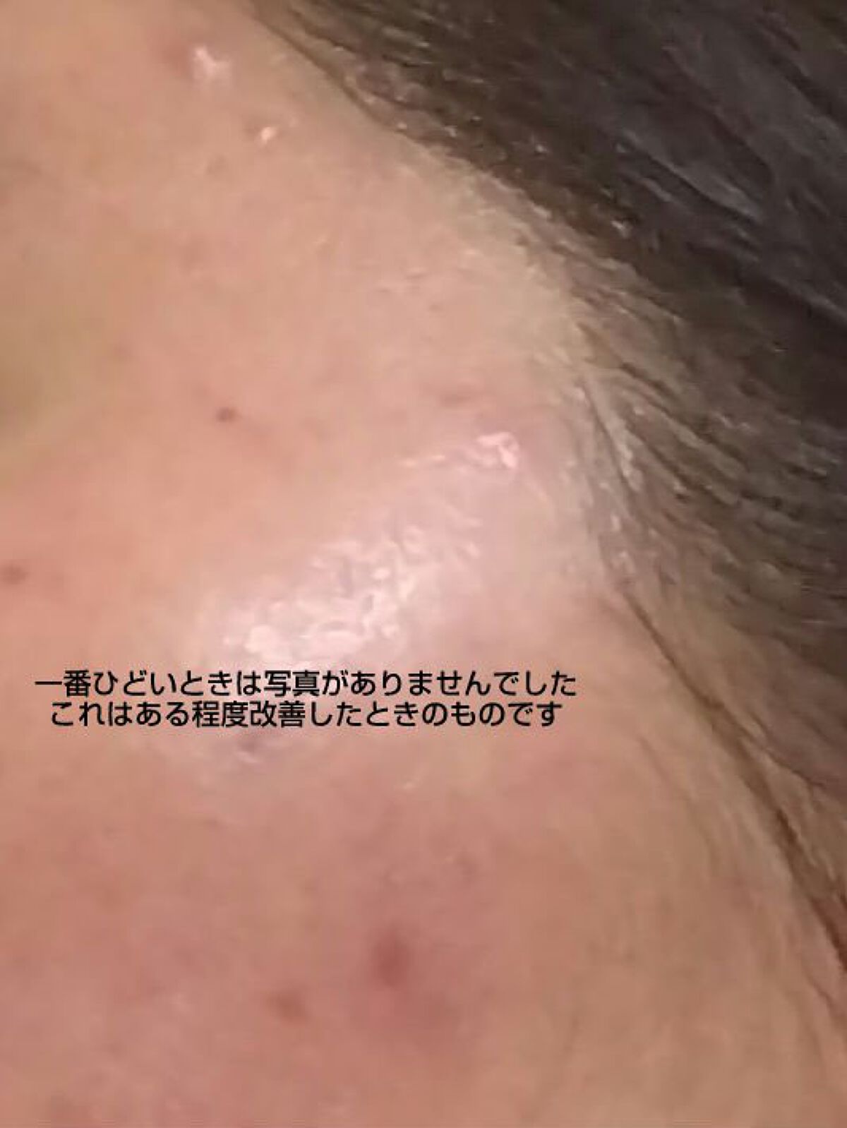 チョコラBBドリンクビット（医薬品）/チョコラBB/その他を使ったクチコミ（2枚目）