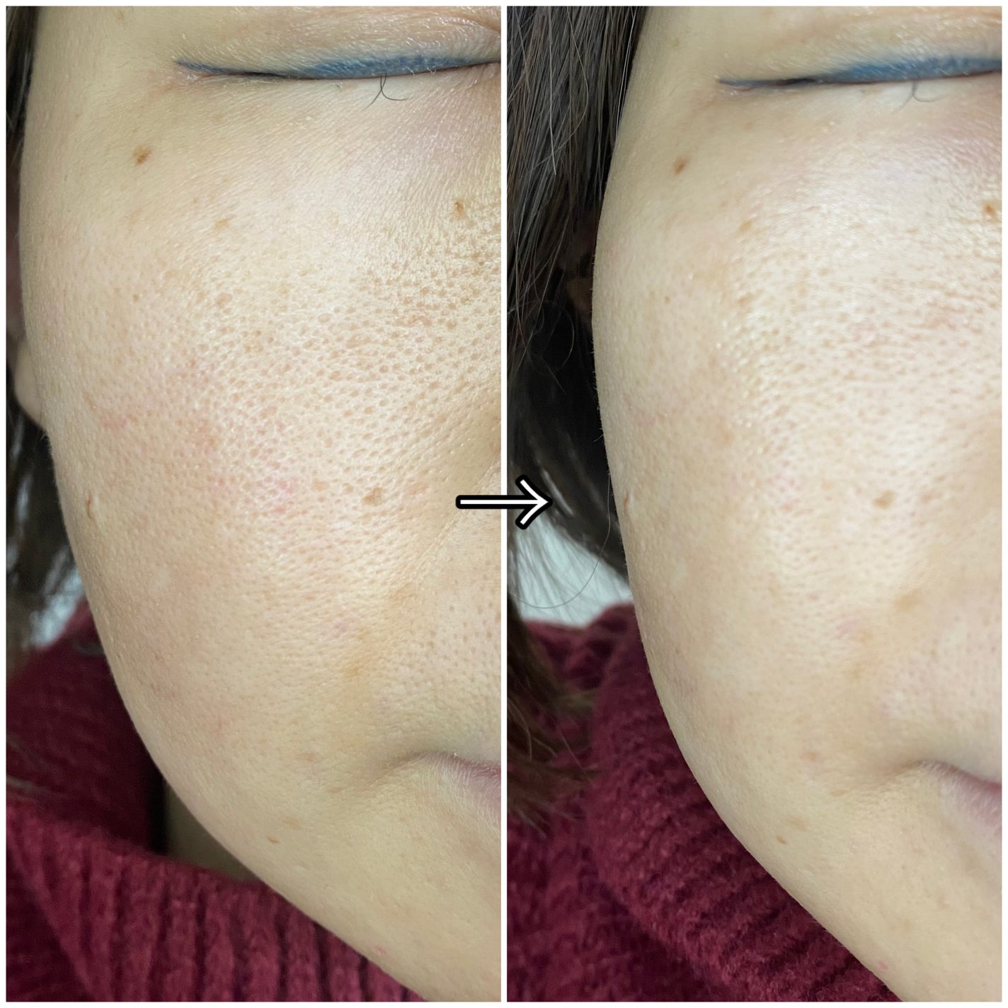 9番 NMNバイオリフトラッピングマスク/numbuzin/シートマスク・パックを使ったクチコミ(8枚目)