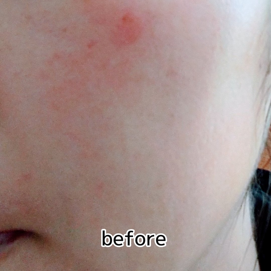 ヨナ フォロバ100 on LIPS 「PROMO様からステファニーサンブロックルーセントパウダーⅢ提..」(4枚目)