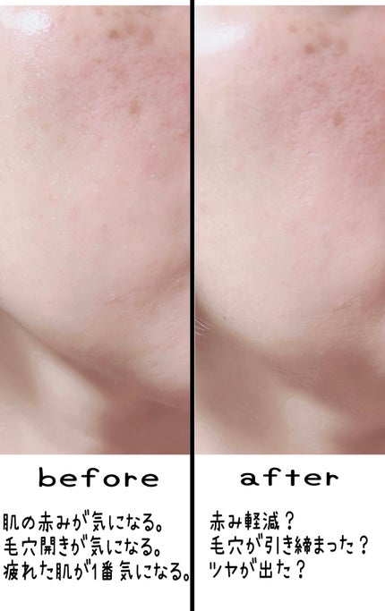 ポイントスキンガーゼ/b idol/化粧水を使ったクチコミ(5枚目)