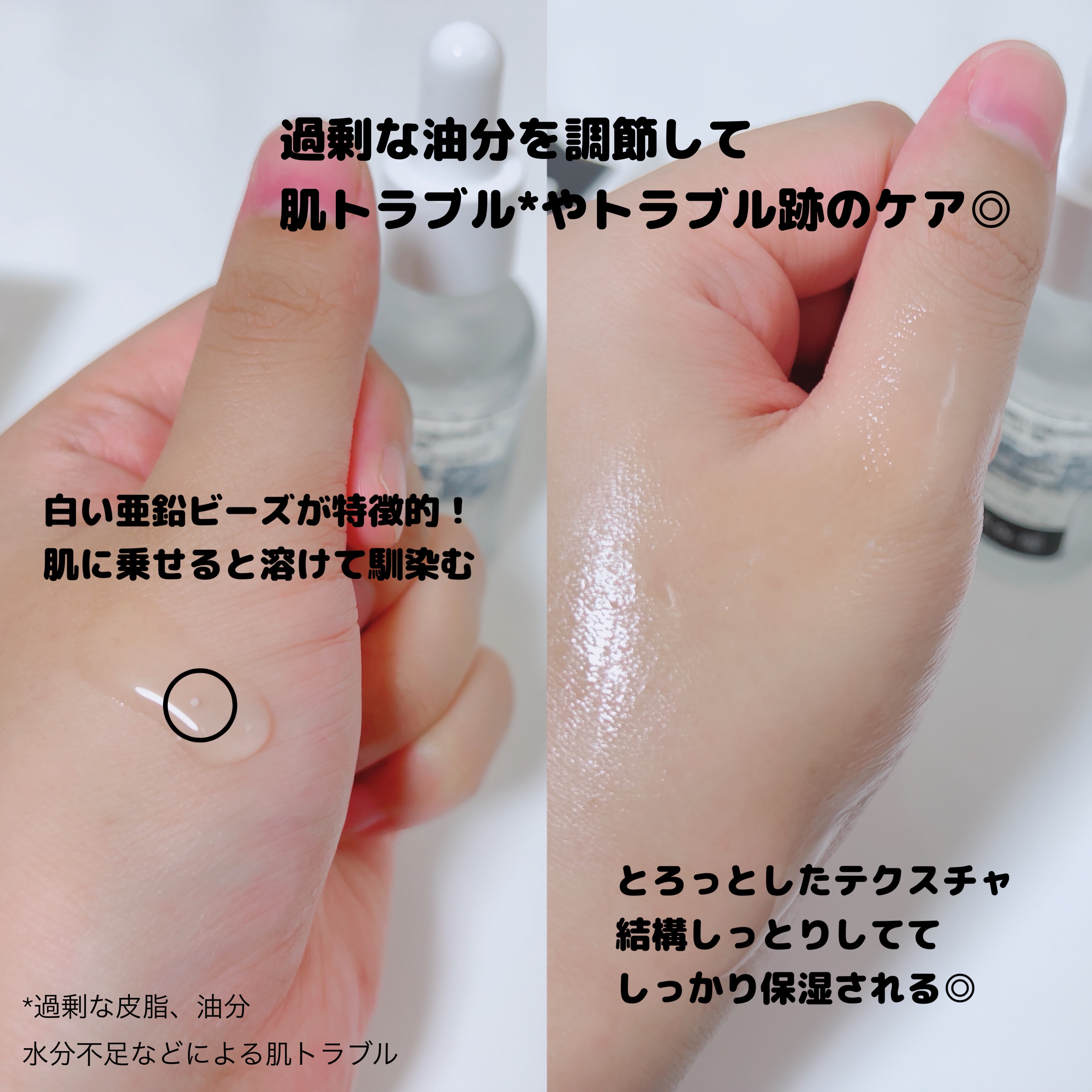 ナイアシンジンクビーズセラム/Frankly/美容液を使ったクチコミ（2枚目）