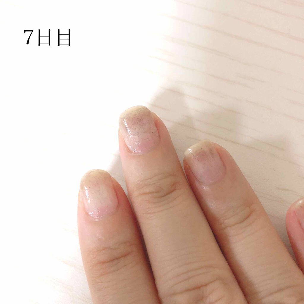 リペクト ネイルセラム/D-UP/ネイルオイル・トリートメントを使ったクチコミ（3枚目）