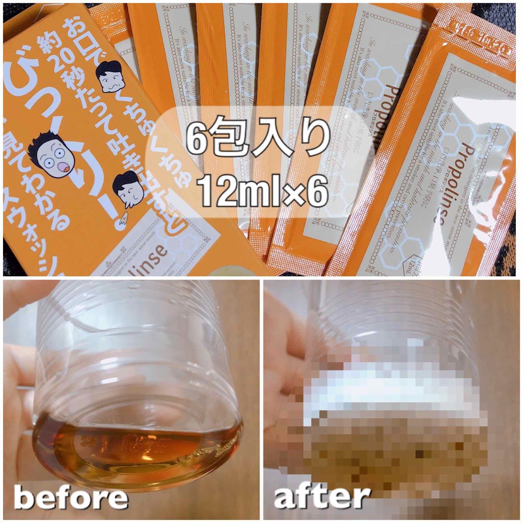 プロポリンス リフレッシュ ハンディパウチ/プロポリンス/マウスウォッシュ・スプレーを使ったクチコミ（2枚目）