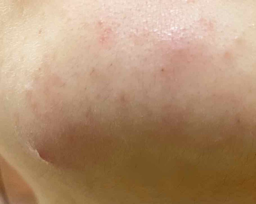 敏感肌用薬用美白美容液/無印良品/美容液を使ったクチコミ（3枚目）