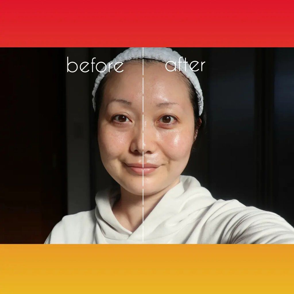 Dr.Arrivo ZeusII/ARTISTIC＆CO./美顔器・マッサージを使ったクチコミ（3枚目）