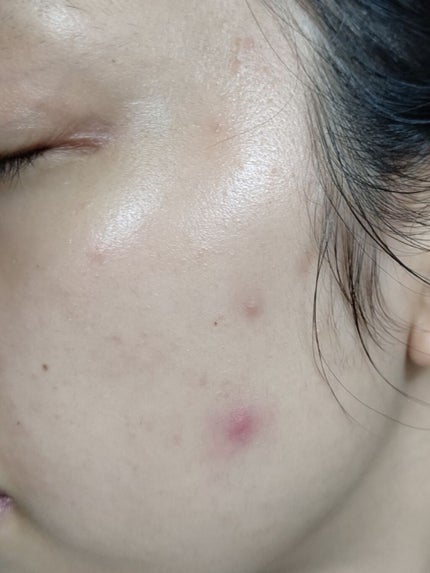 フルコートF(医薬品)/田辺三菱製薬/その他を使ったクチコミ(3枚目)