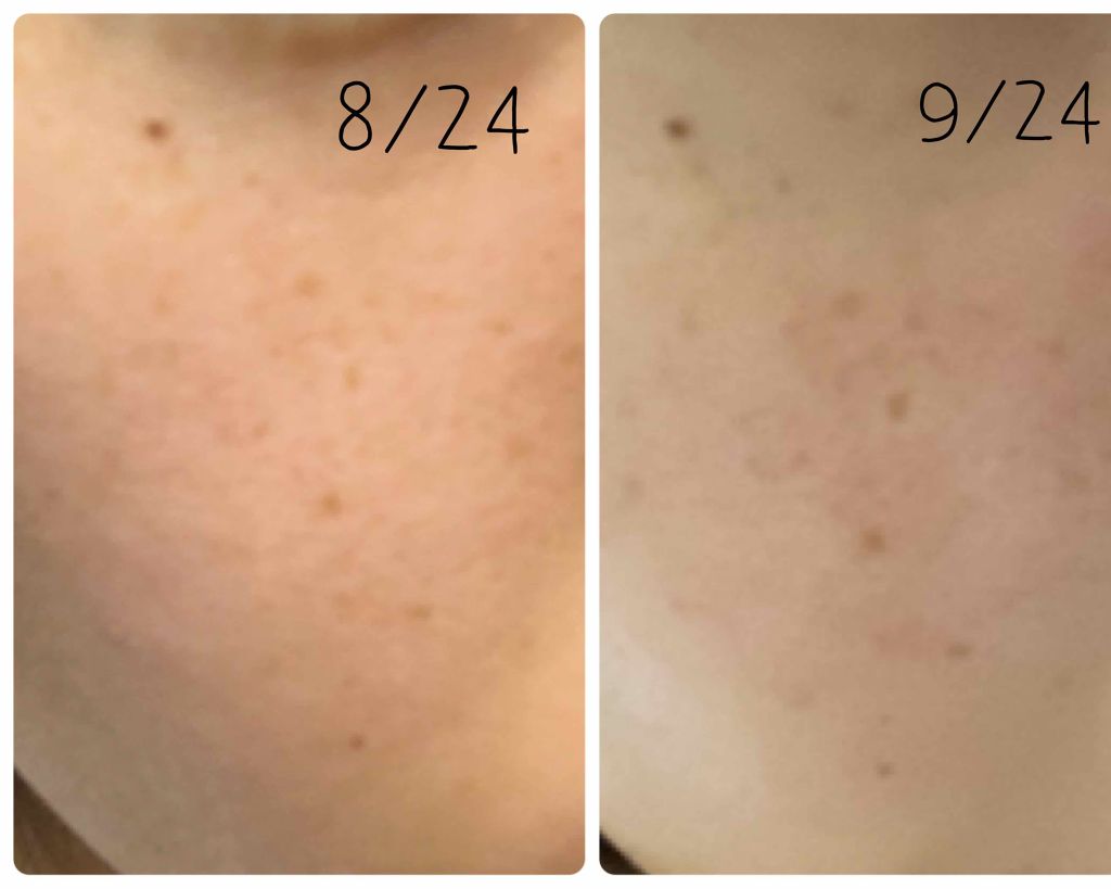 敏感肌用薬用美白美容液/無印良品/美容液を使ったクチコミ（2枚目）