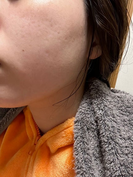 カプセルレシピパック N B&T/innisfree/洗い流すパック・マスクを使ったクチコミ(4枚目)