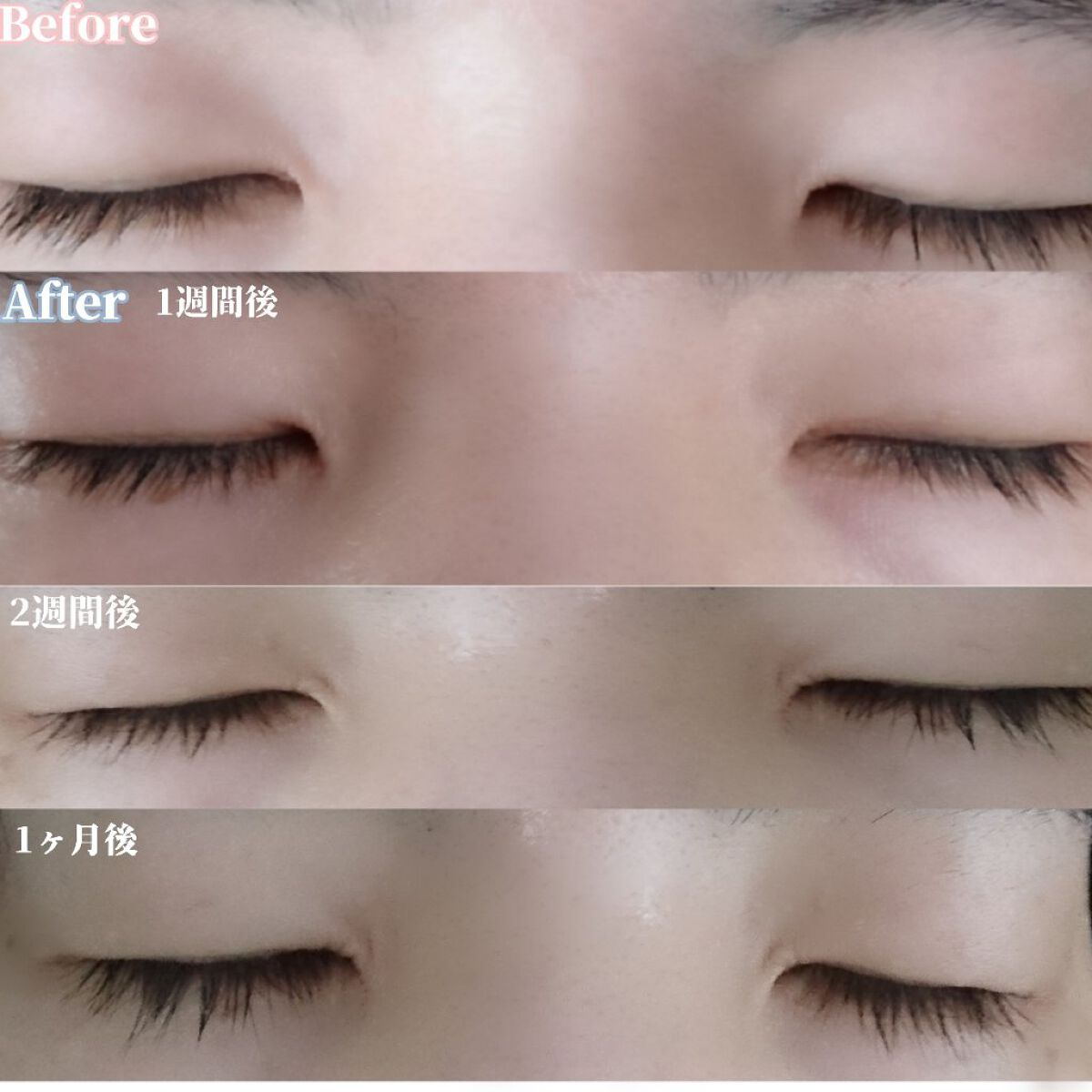 EMAKED(エマーキット)/水橋保寿堂製薬/まつげ美容液を使ったクチコミ(4枚目)