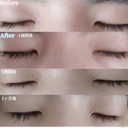 EMAKED(エマーキット)/水橋保寿堂製薬/まつげ美容液を使ったクチコミ(4枚目)