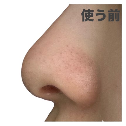 ゼロ毛穴パッド 2.0/MEDICUBE/トナーパッドを使ったクチコミ(4枚目)