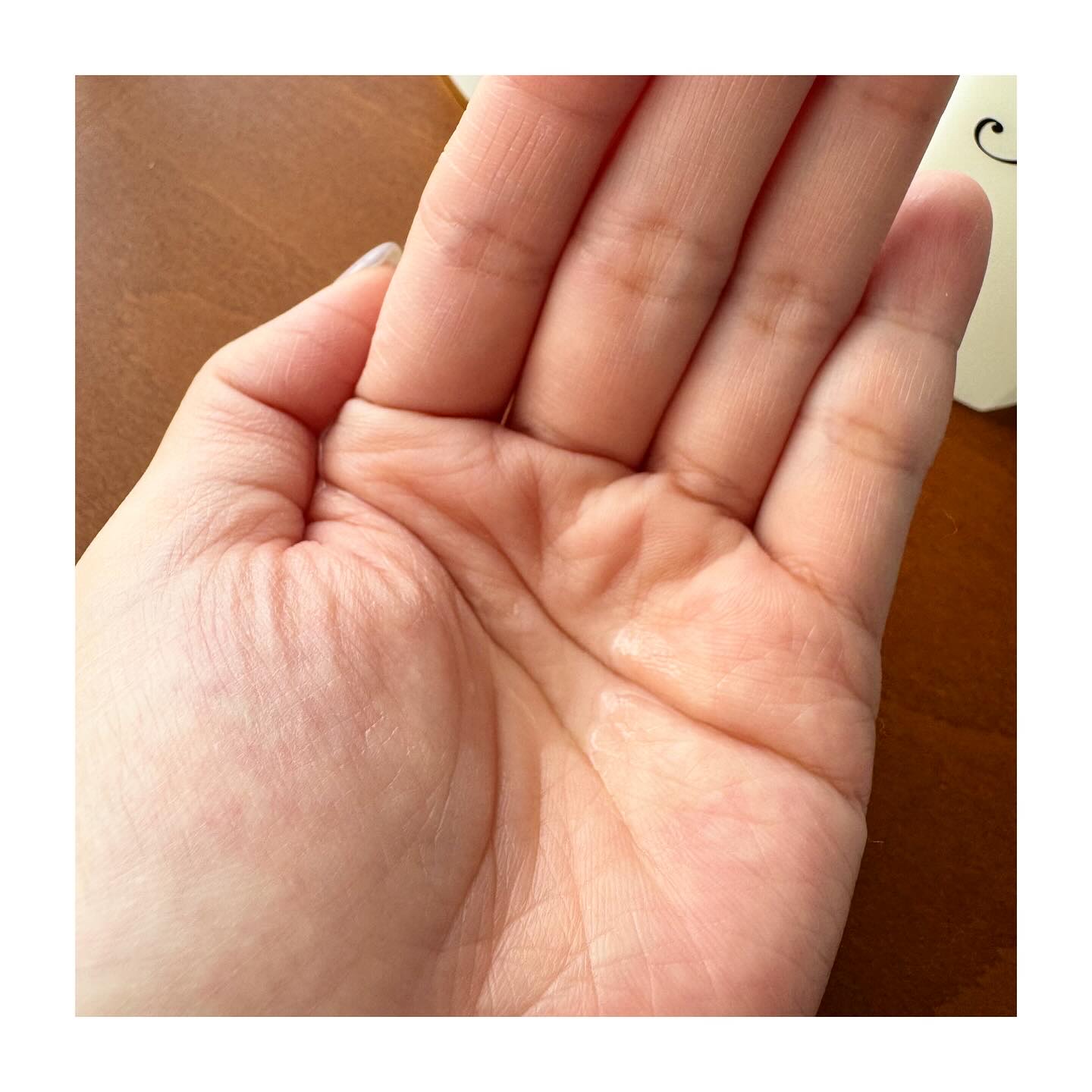 リッチ ローション/イオナ エフ/化粧水を使ったクチコミ（2枚目）