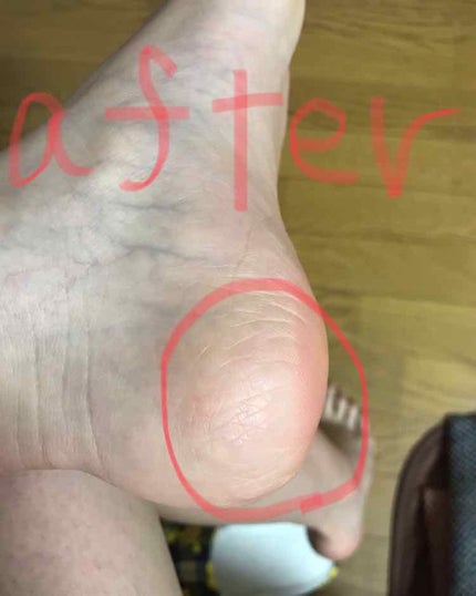 ボディ スムーザー /ハウス オブ ローゼ/ボディスクラブを使ったクチコミ(3枚目)