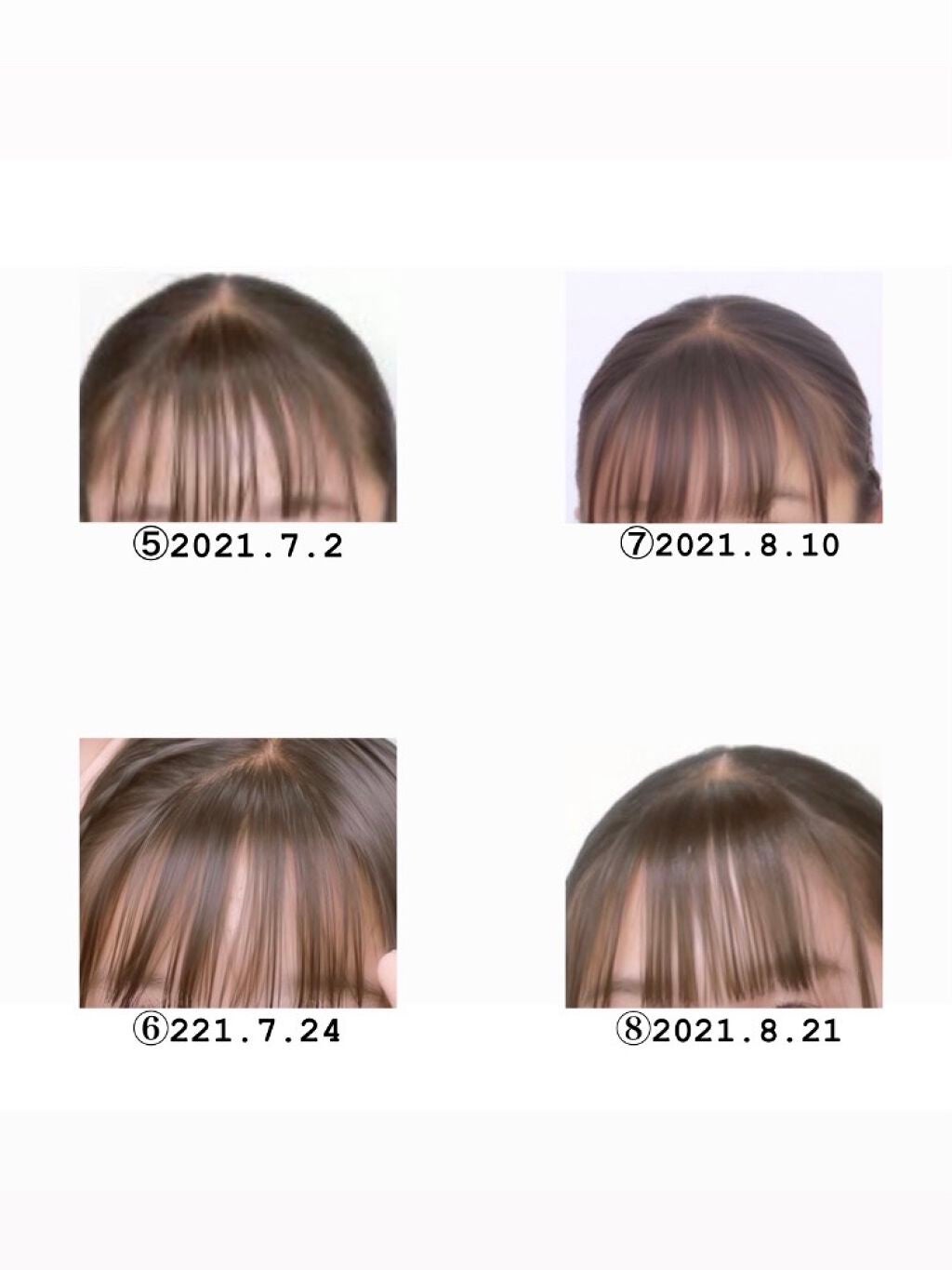 のあ on LIPS 「初投稿は私の前髪の垢抜け歴史です!これを見てくださってる方々に..」(3枚目)