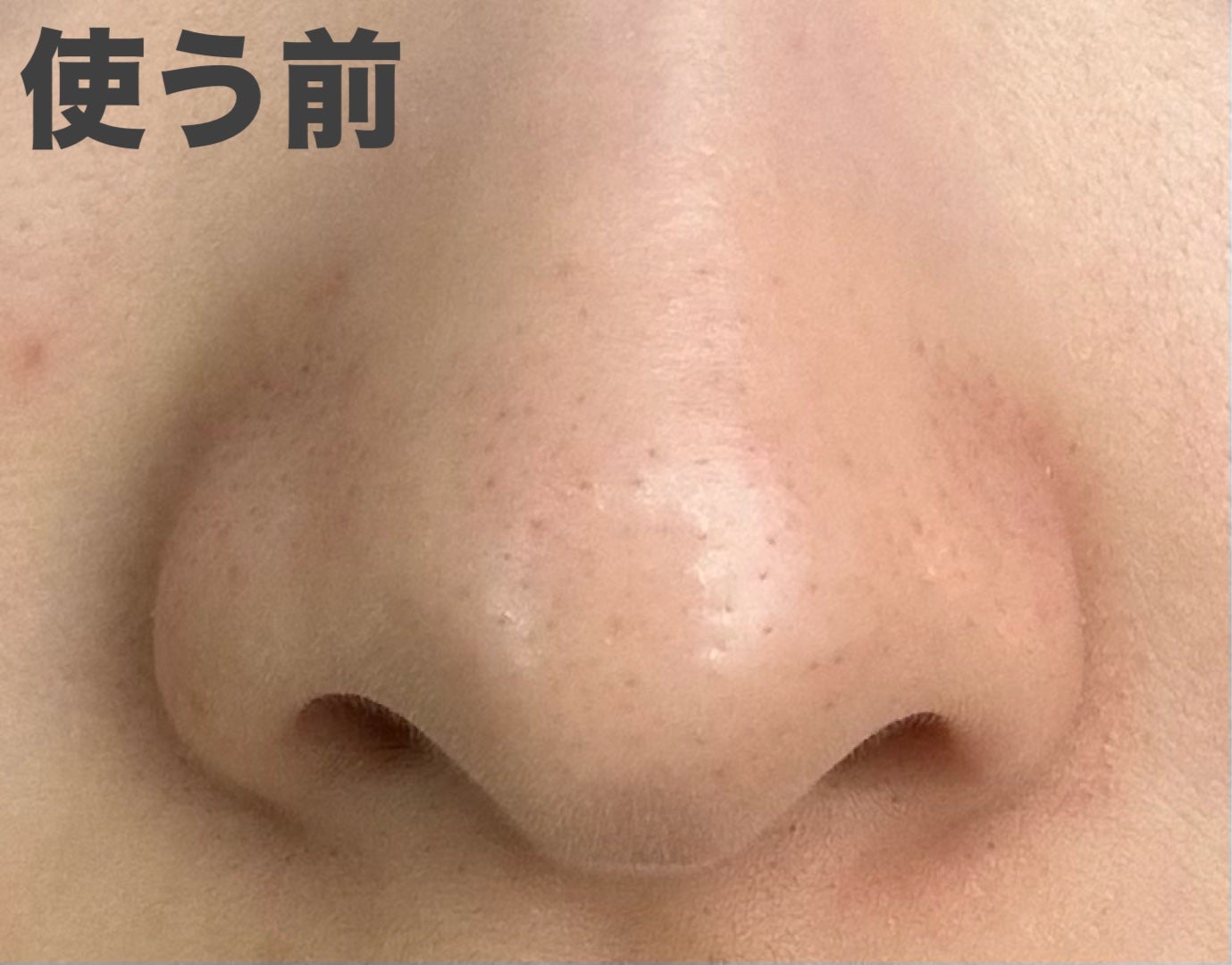 ゼロ毛穴パッド 2.0/MEDICUBE/トナーパッドを使ったクチコミ(2枚目)