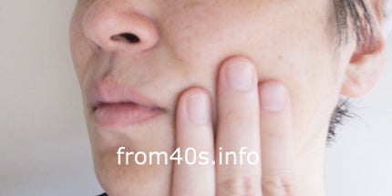 ピールローションプレミアム/BEAUTY MALL/ブースター・導入液を使ったクチコミ(4枚目)