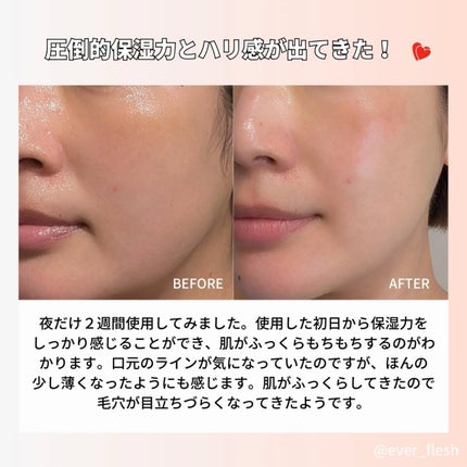 PDRNカフェインショット/IOPE/美容液を使ったクチコミ(5枚目)