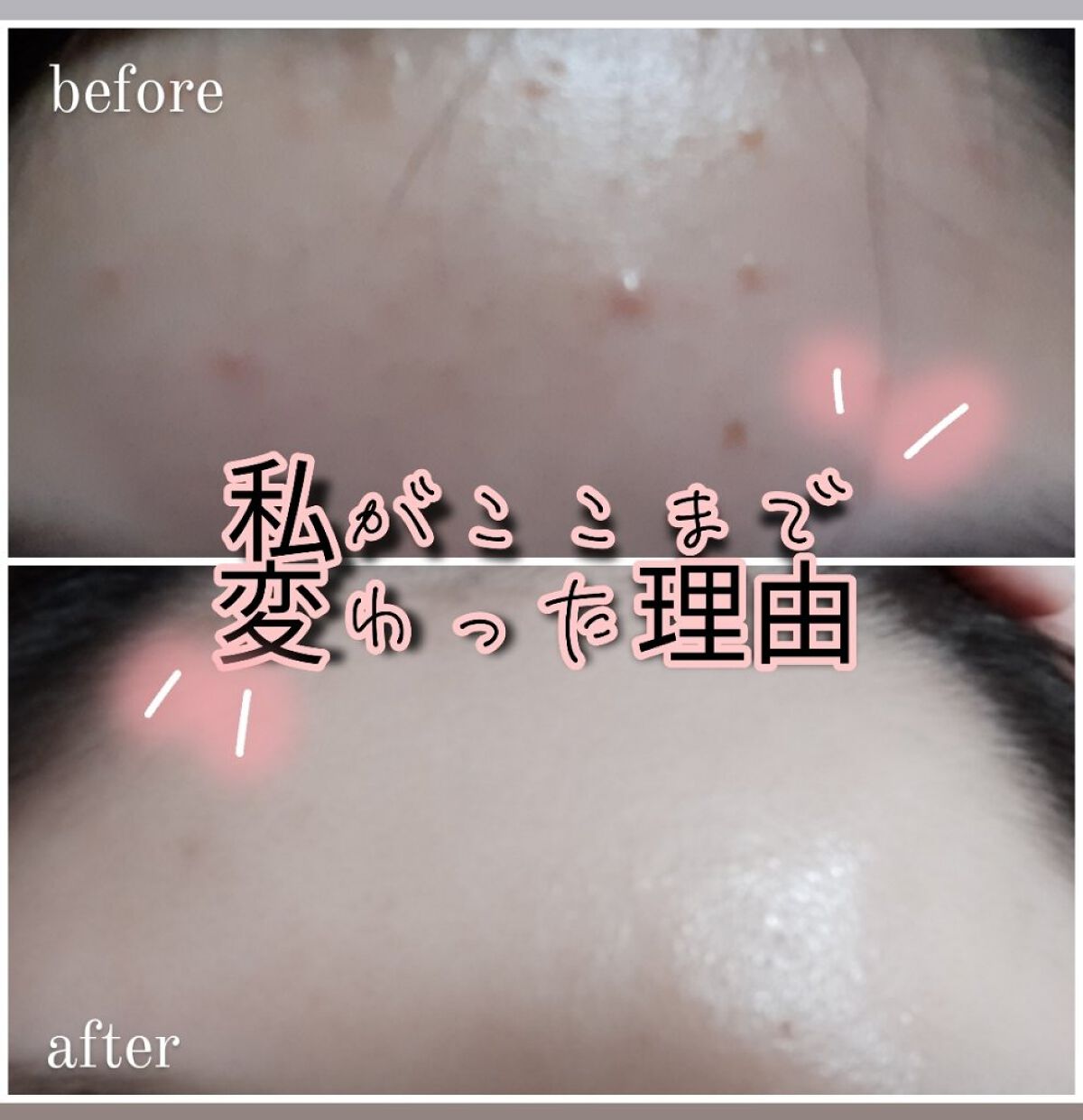 リセットクリアN/BENEFIQUE/化粧水を使ったクチコミ（1枚目）