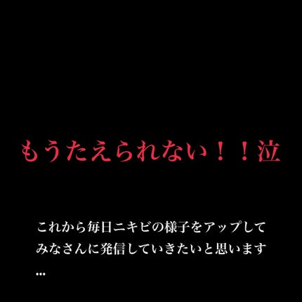 ニキビあとケアジェル/アットノン/その他スキンケアを使ったクチコミ(1枚目)
