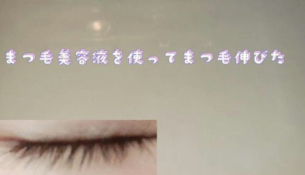 MAアイラッシュセラム/MATSUGE OMOI/まつげ美容液を使ったクチコミ(2枚目)