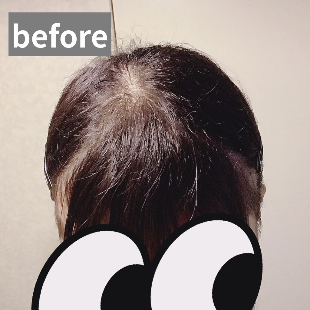 スーパーキープヘアスプレイ＜エクストラハード＞ 無香料/VO5/ヘアスプレーを使ったクチコミ（2枚目）