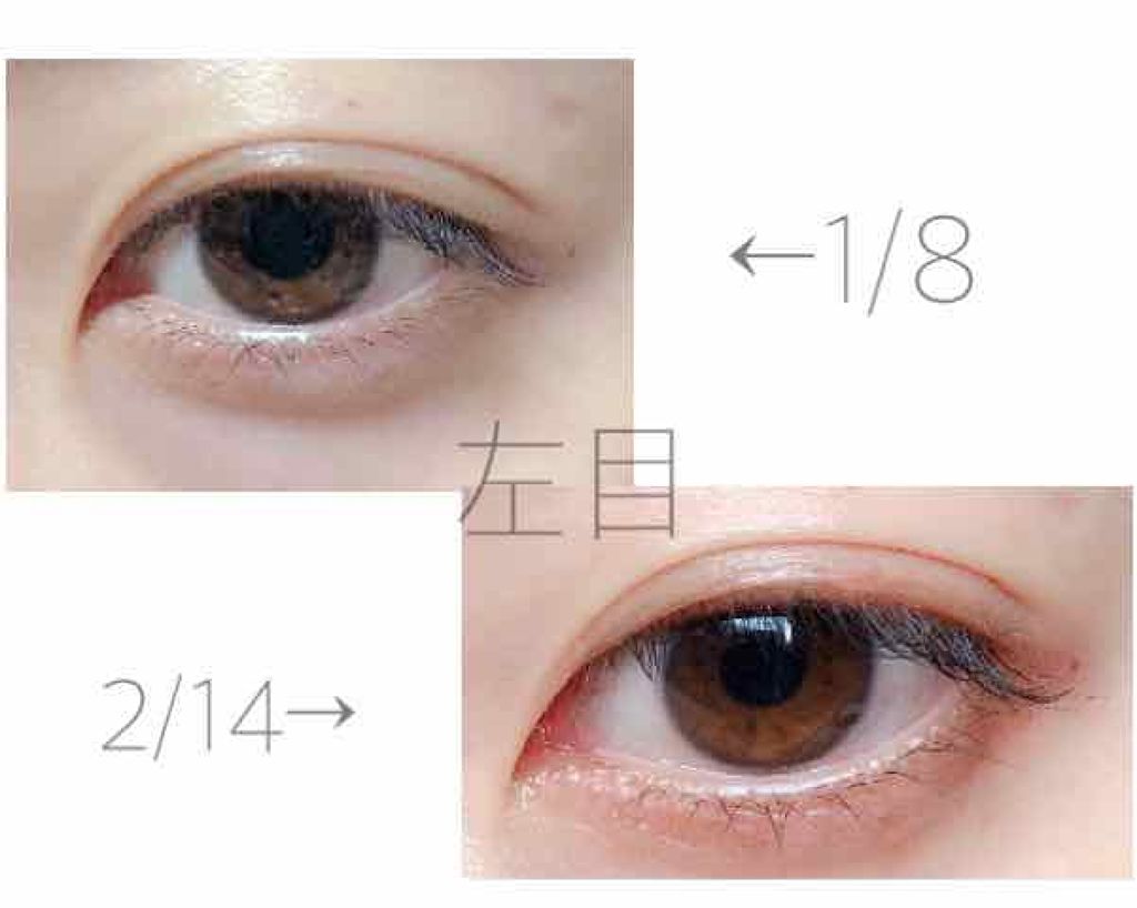 砂糖 on LIPS 「⚠️2枚目以降に目の画像があります⚠️みなさんこんばんは砂糖で..」(4枚目)