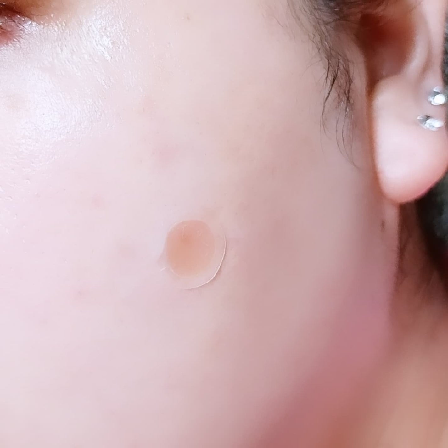 ♡ななち♡ on LIPS 「ノラアワー(NOLAHOUR)スポットイレーザー3ステップを使..」(6枚目)