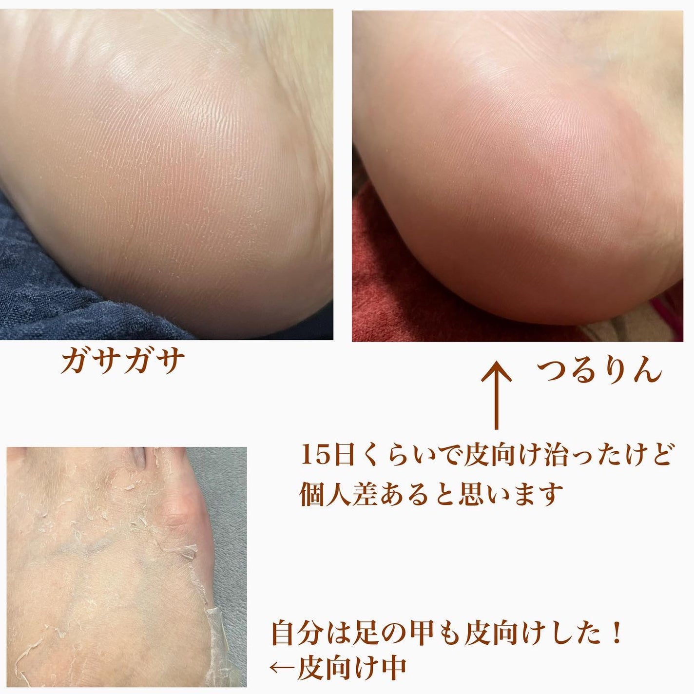 イージーパックDP60分タイプ/ベビーフット/レッグ・フットケアを使ったクチコミ(4枚目)