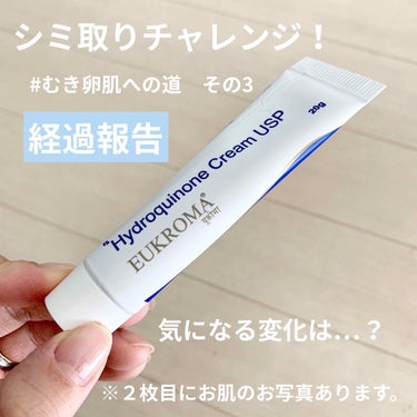 
#むき卵肌への道　その3


⚠️ハイドロキノン、レチノール共にとても刺激の強いクリームです。ご興味のある方は用量用法しっかり確認してから、自己責任でお願いします🙏⚠️

⚠️画像２枚目肌のお写真あり