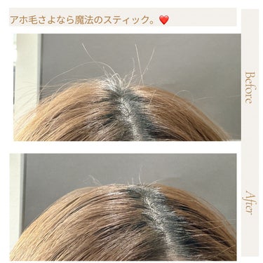 エルジューダ  ポイントケアスティック/エルジューダ/ヘアジェルを使ったクチコミ（2枚目）